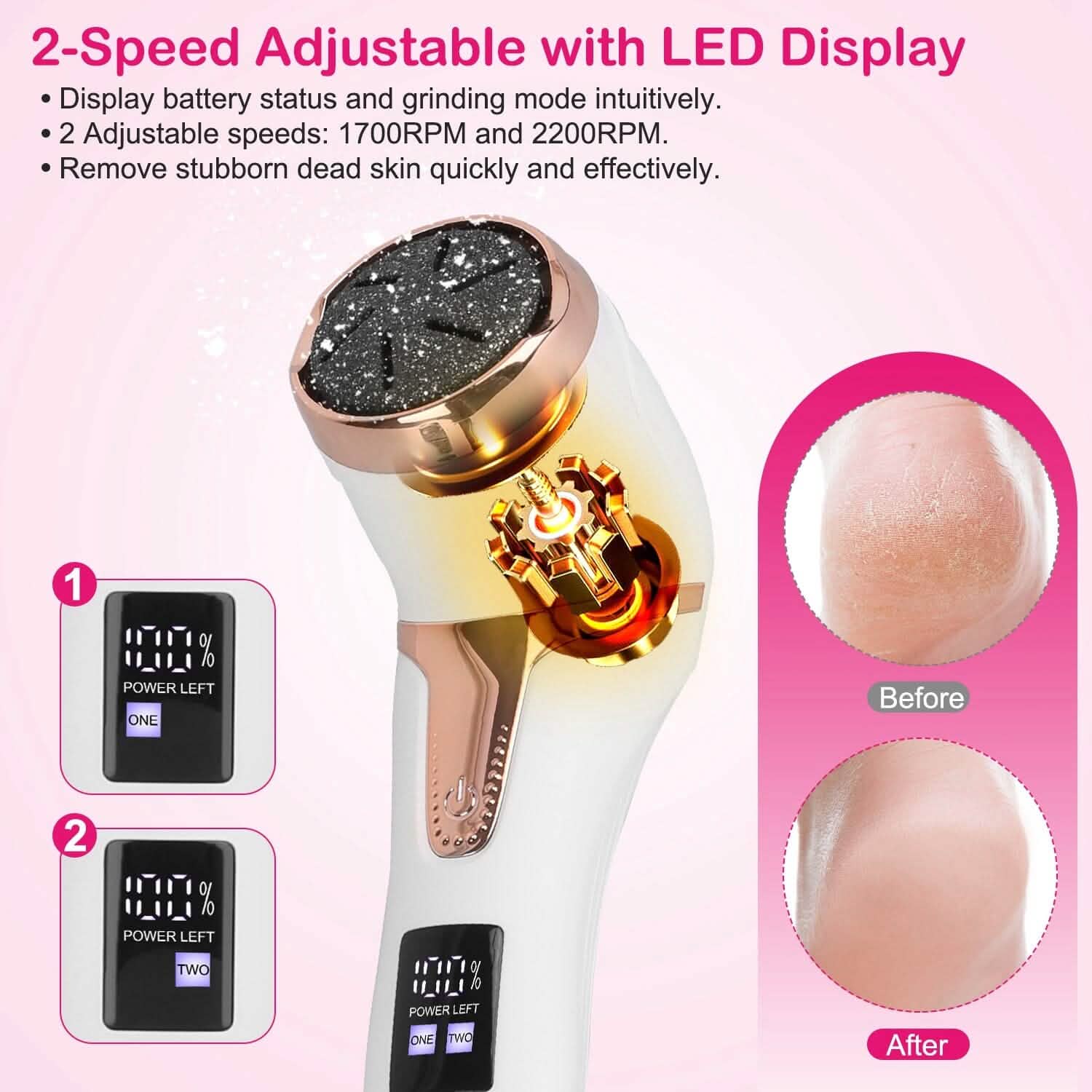 17-Pieces Set: Electric Foot Callus Remover with Vacuum Foot Grinder Rechargeable