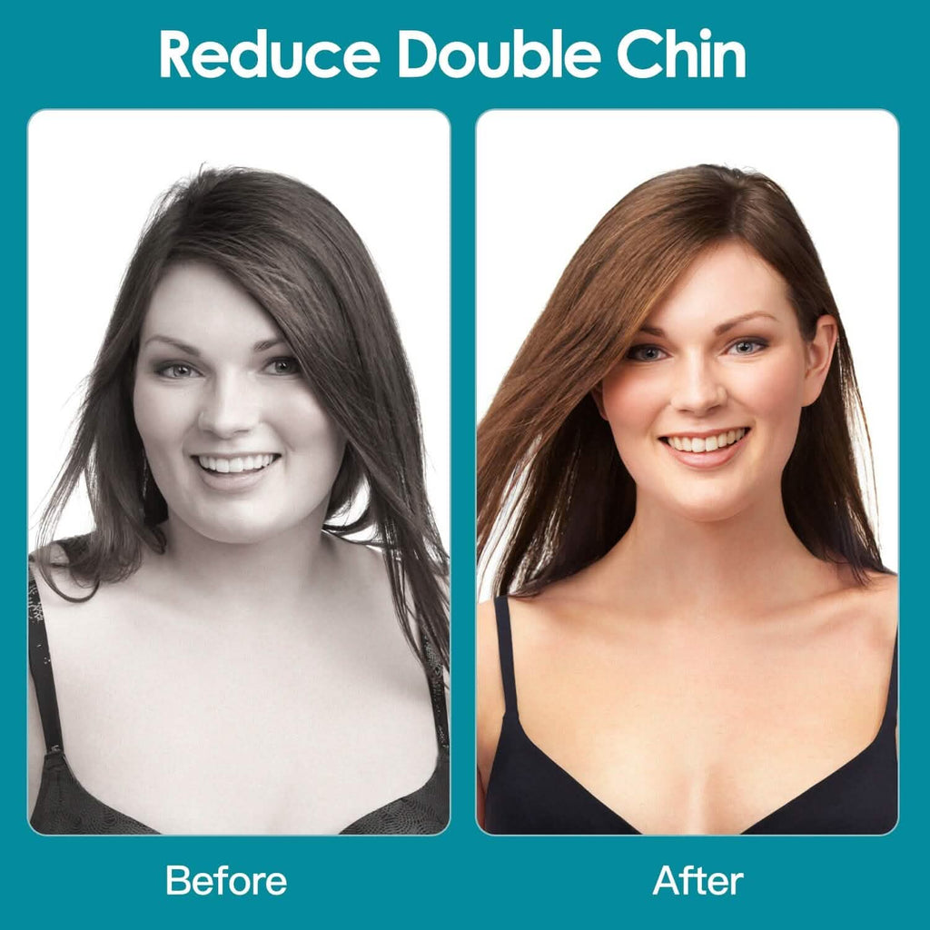 4-Pack: Jawline Exerciser with 3 Resistance Levels