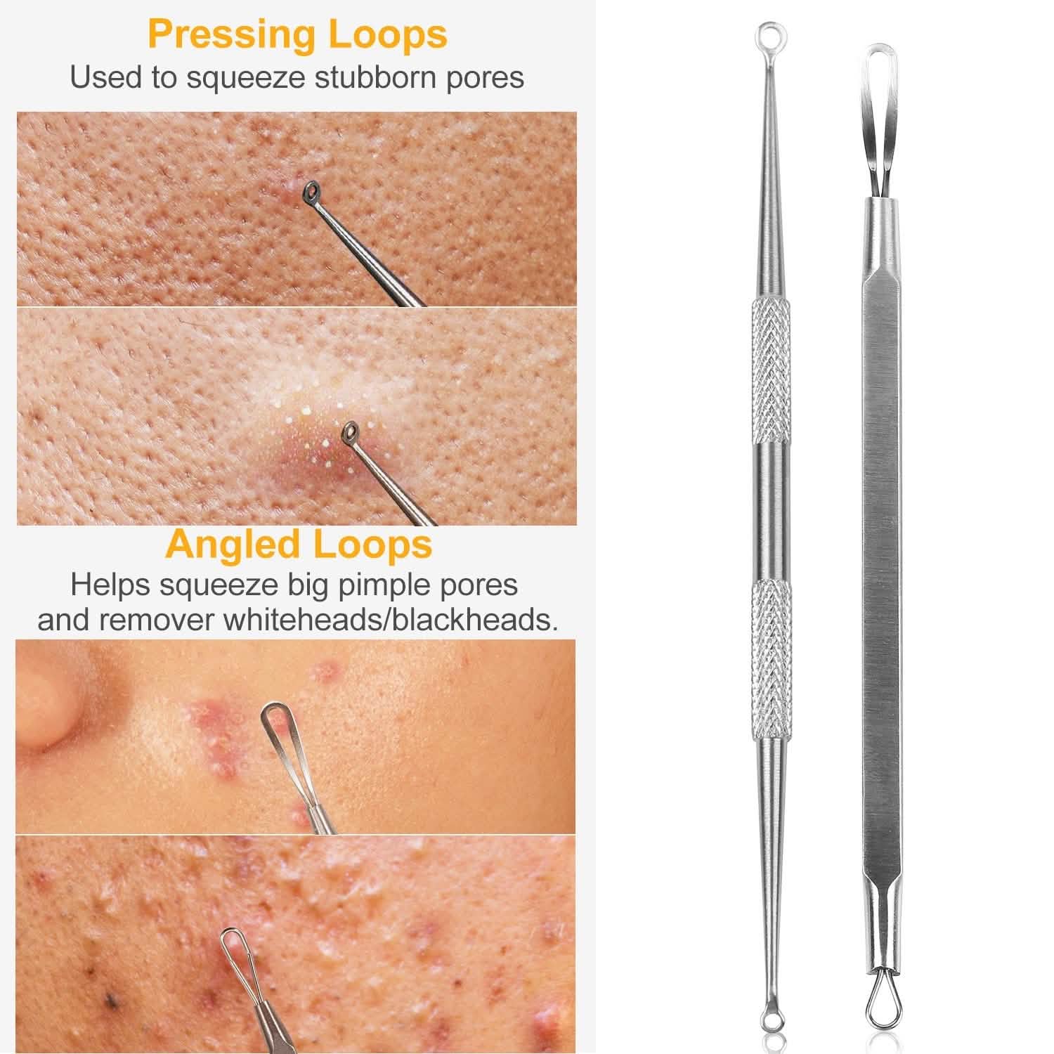 Ensemble de 5 pièces : Kit Dissolvant de Points Noirs en Acier Inoxydable, Outil pour l'Extraction des Boutons