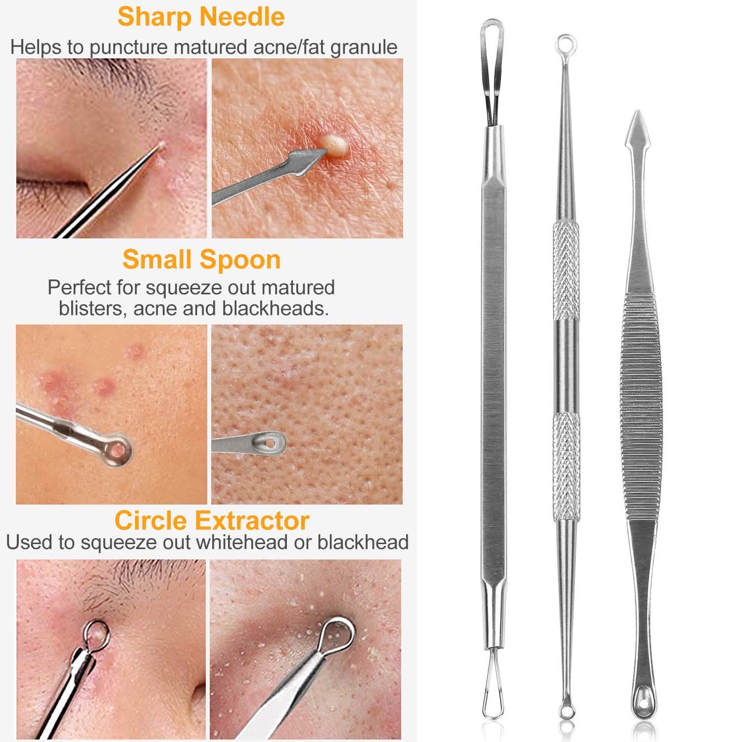 Ensemble de 5 pièces : Kit Dissolvant de Points Noirs en Acier Inoxydable, Outil pour l'Extraction des Boutons