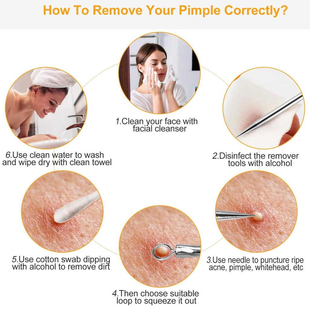 Ensemble de 5 pièces : Kit Dissolvant de Points Noirs en Acier Inoxydable, Outil pour l'Extraction des Boutons