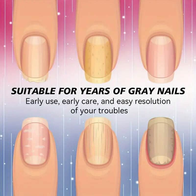 64 pièces : Pansements pour ongles de pieds, traitement extra fort pour la réparation des ongles