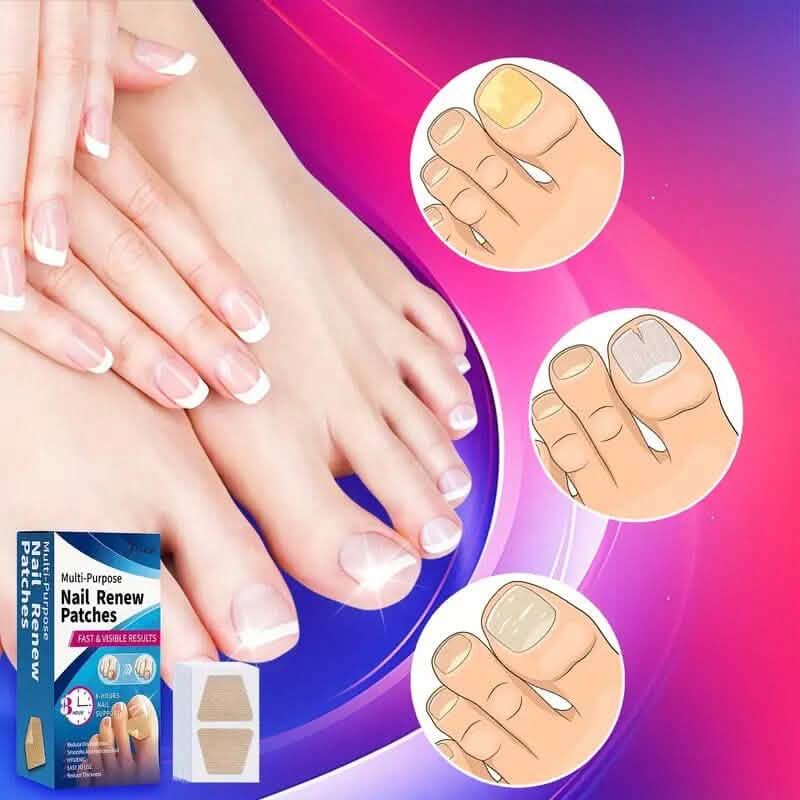64 pièces : Pansements pour ongles de pieds, traitement extra fort pour la réparation des ongles
