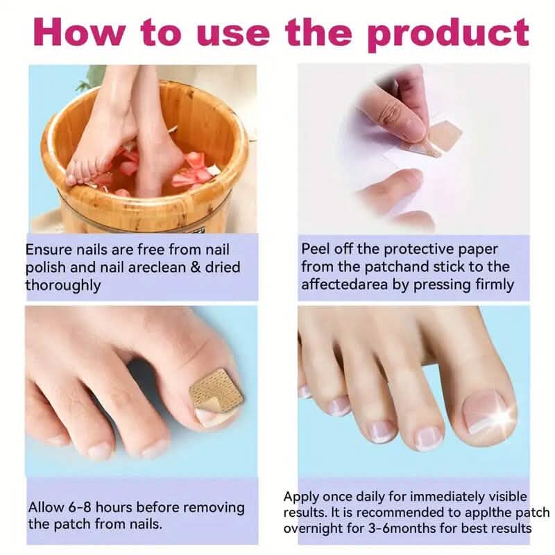 64 pièces : Pansements pour ongles de pieds, traitement extra fort pour la réparation des ongles
