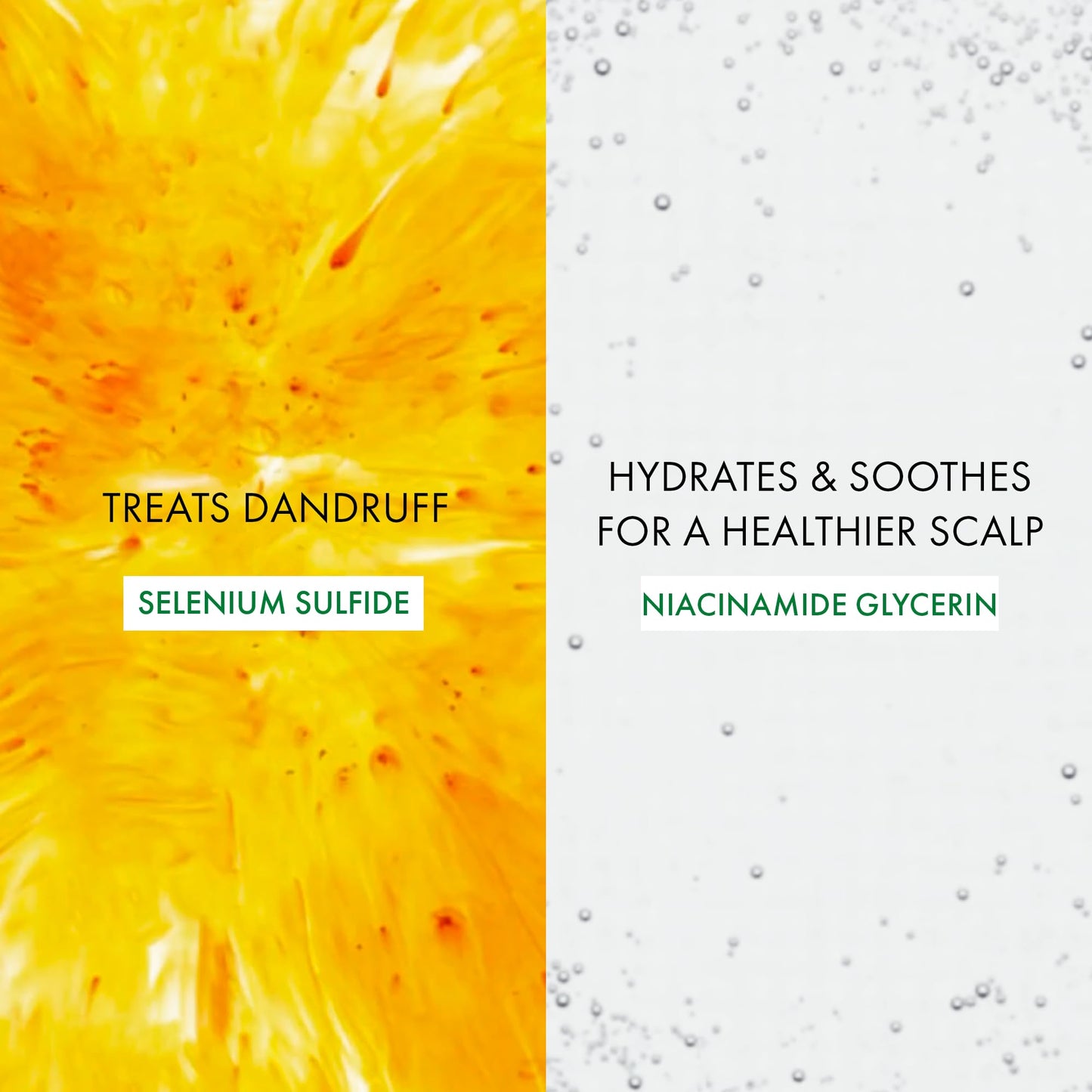 Vichy Dercos Anti-Pelliculaire Dandrufff 390 ml