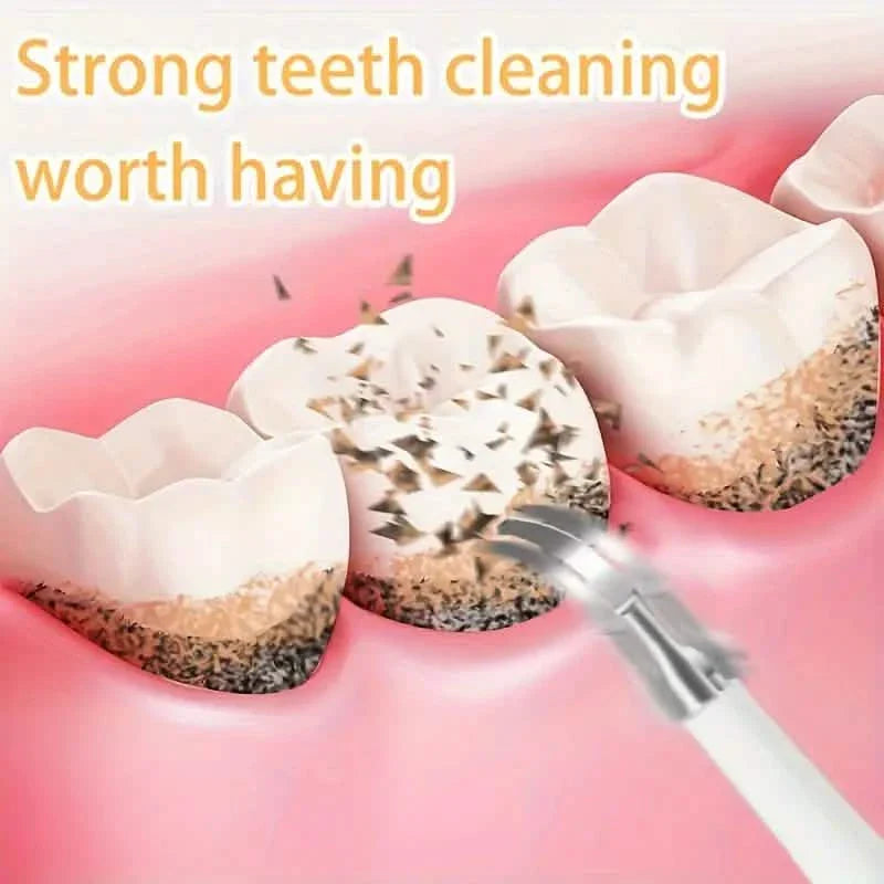 Outil de nettoyage de dents électrique avancé puissant dissolvant de tartre et de plaque dentaire