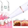 Outil de nettoyage de dents électrique avancé puissant dissolvant de tartre et de plaque dentaire