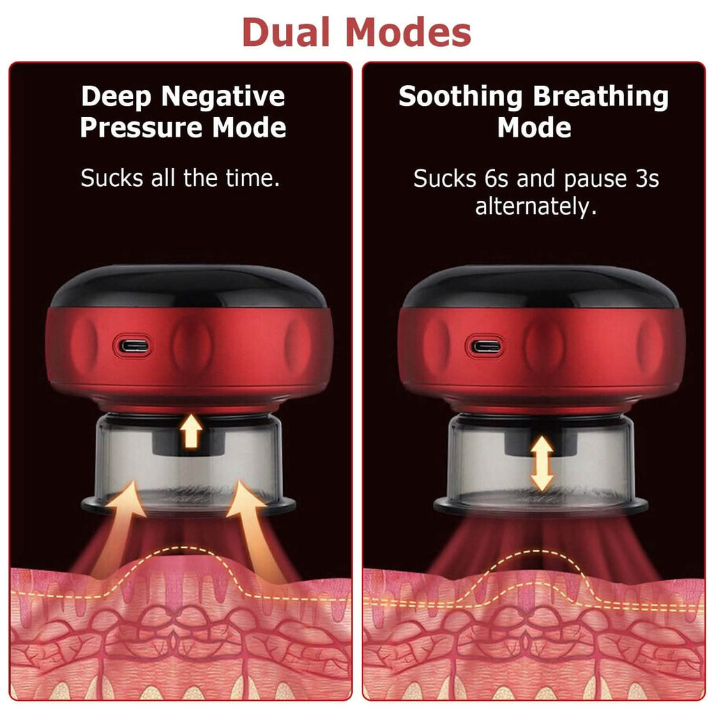 Electric Back Scraping Machine Vacuum Therapy Cupping Device