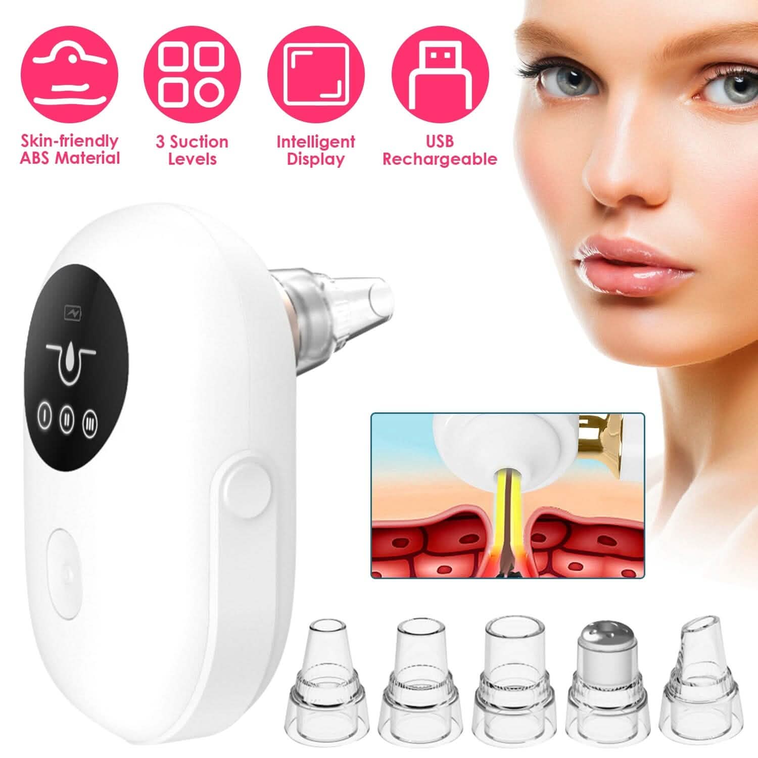 Extracteur électrique de points noirs et de comédons Outil de nettoyage des pores du visage