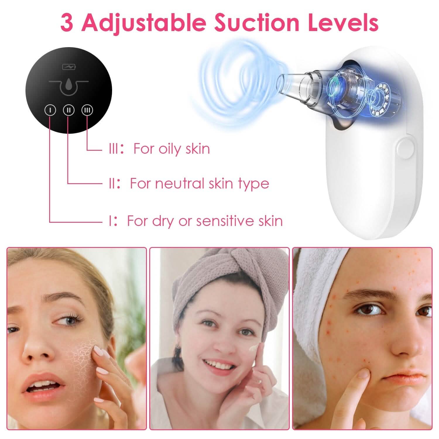 Extracteur électrique de points noirs et de comédons Outil de nettoyage des pores du visage