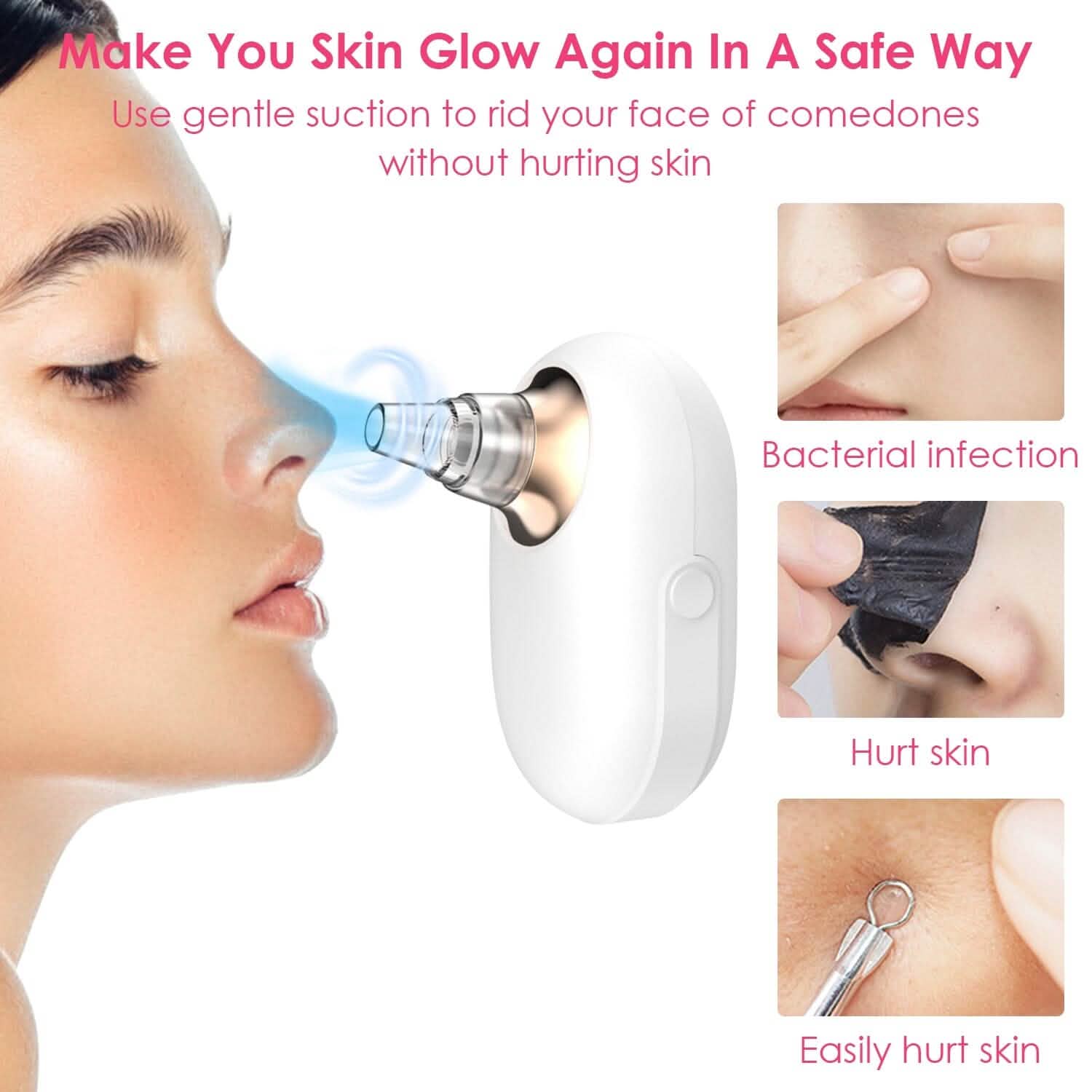 Extracteur électrique de points noirs et de comédons Outil de nettoyage des pores du visage