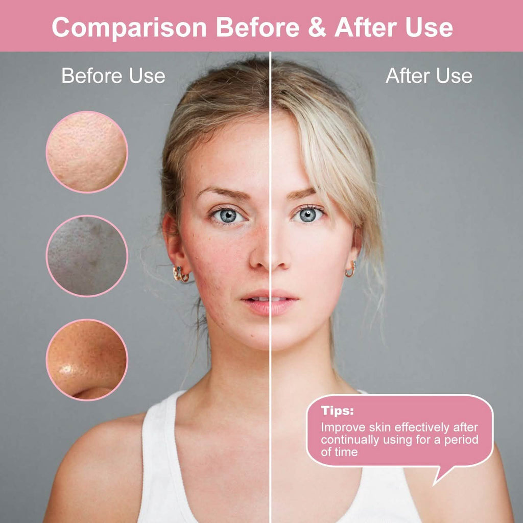 Facial Cleansing Brush IPX6 Waterproof 2 Speed Face Brush