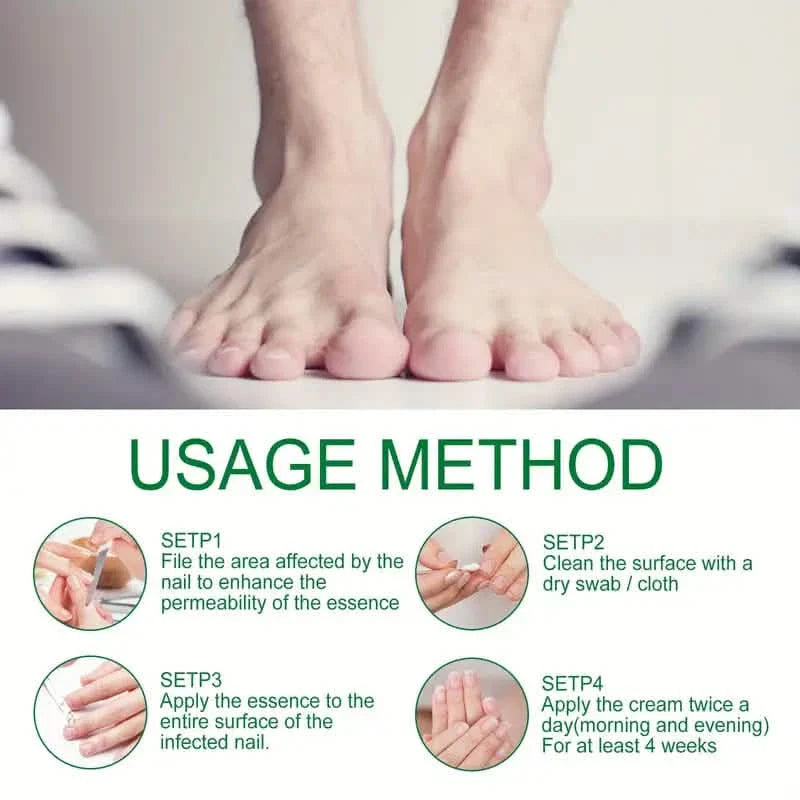 Ginger Nail Care Liquid Onychomycosis Fungus Repair Hand and Foot Nail Care