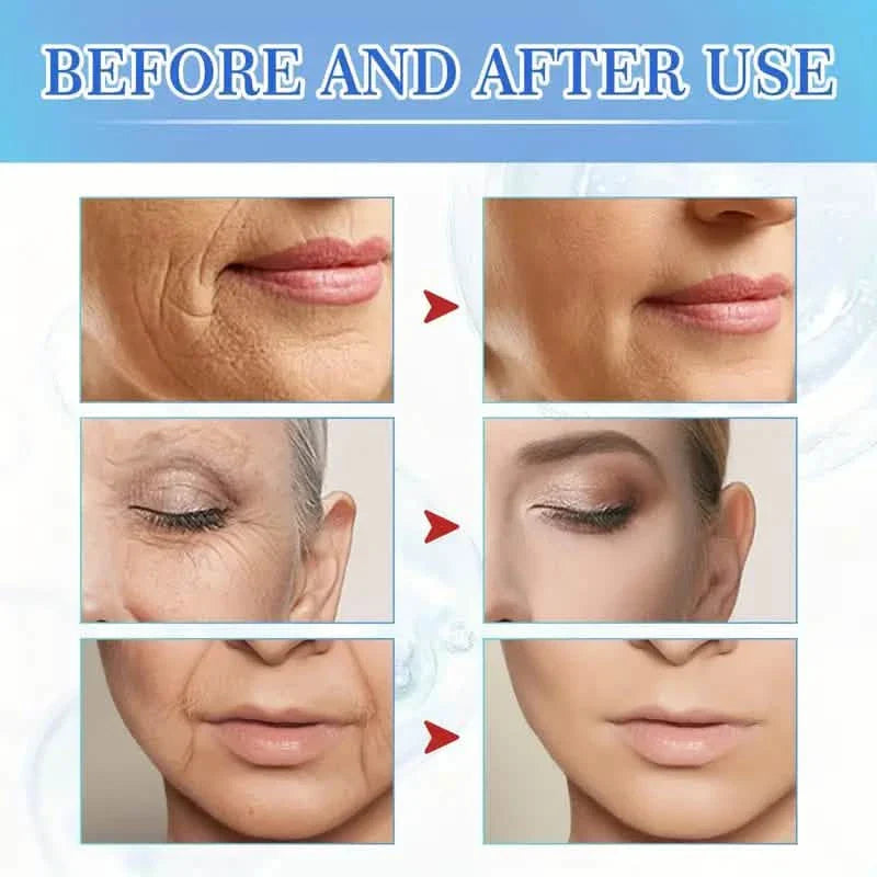Intensive Anti Aging Botox Facial Serum - Collagen Serum For Skin With Vitamin C, Hyaluronic Acid and Niacinamide