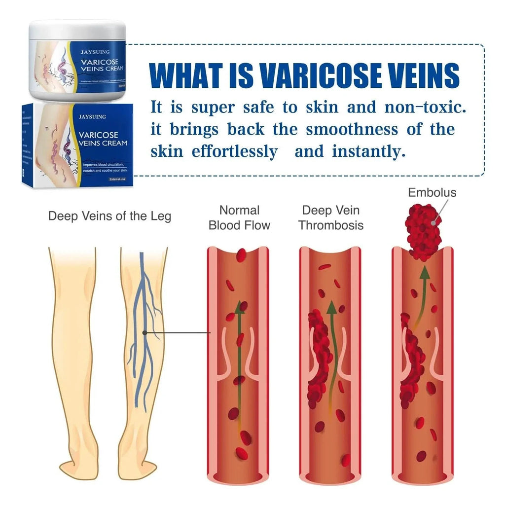 Soulagement de la douleur Jambes Veines Araignées Vascularite Favorise la circulation Métabolisme doux 30g Exfoliation
