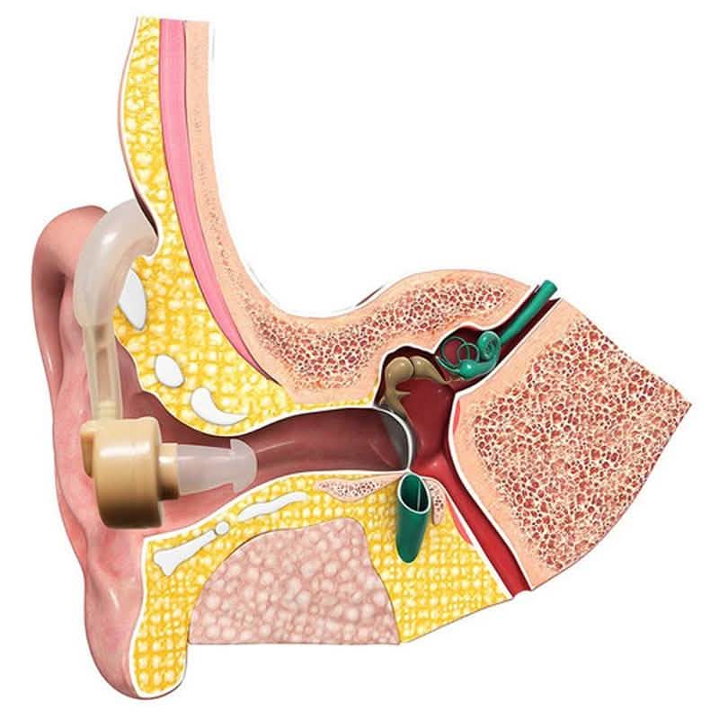 Personal Sound Amplifier Hearing Aid with Protective Case