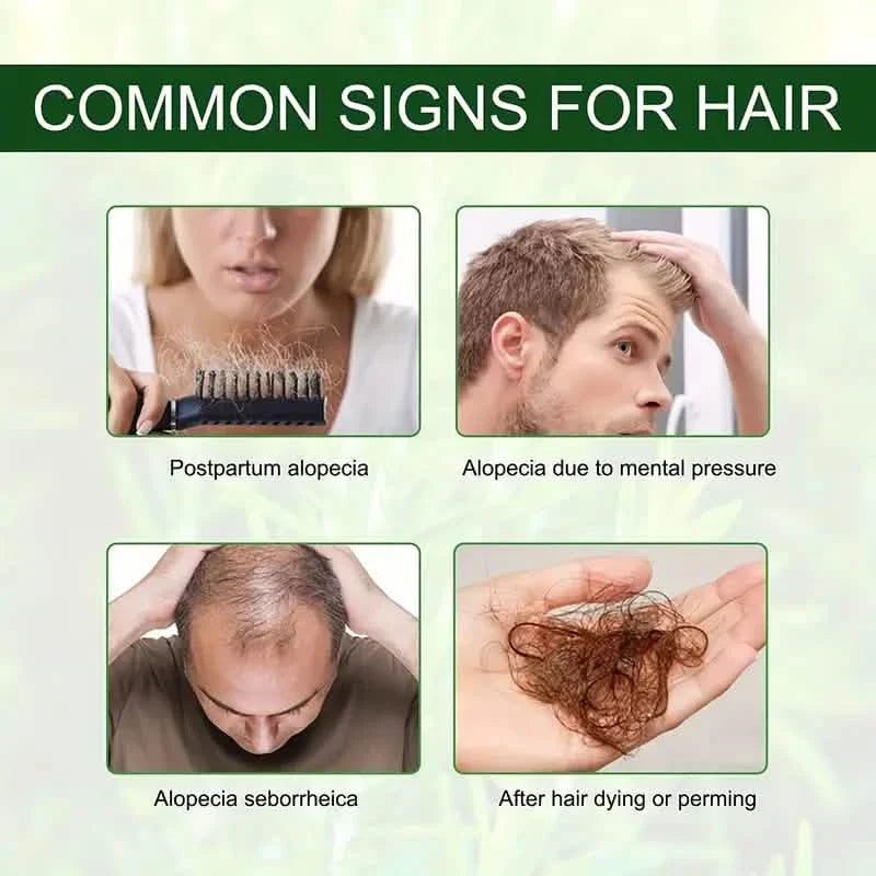 Huile essentielle de romarin pour les soins capillaires, le massage du cuir chevelu, les soins de la peau et l'aromathérapie