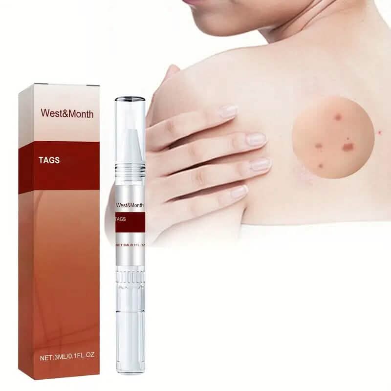 Skin Tag Removal Pen