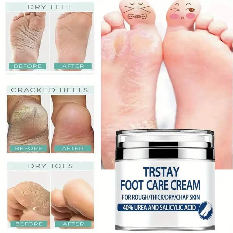 Crème de soin des pieds Trstay 50g / Crème de soin des pieds 40% urée et acide salicylique