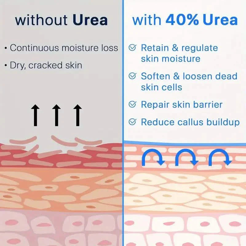Crème de soin des pieds Trstay 50g / Crème de soin des pieds 40% urée et acide salicylique