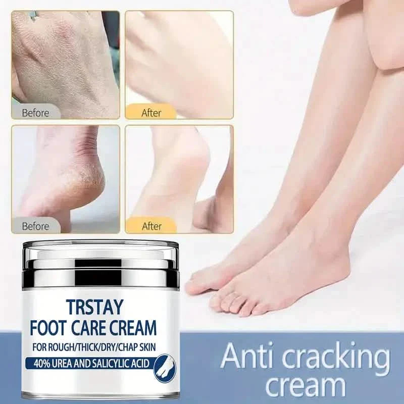 Crème de soin des pieds Trstay 50g / Crème de soin des pieds 40% urée et acide salicylique