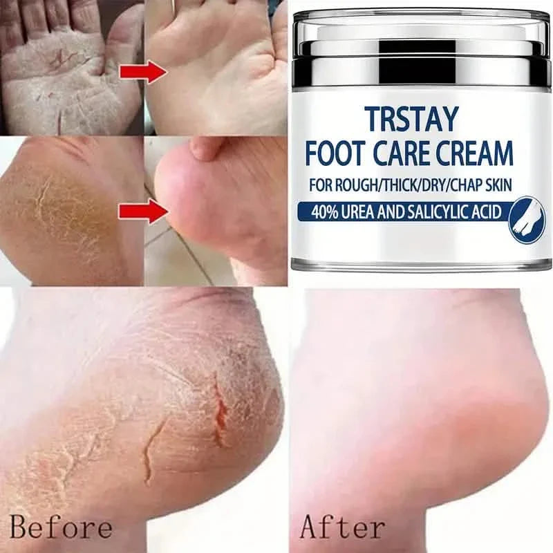 Crème de soin des pieds Trstay 50g / Crème de soin des pieds 40% urée et acide salicylique